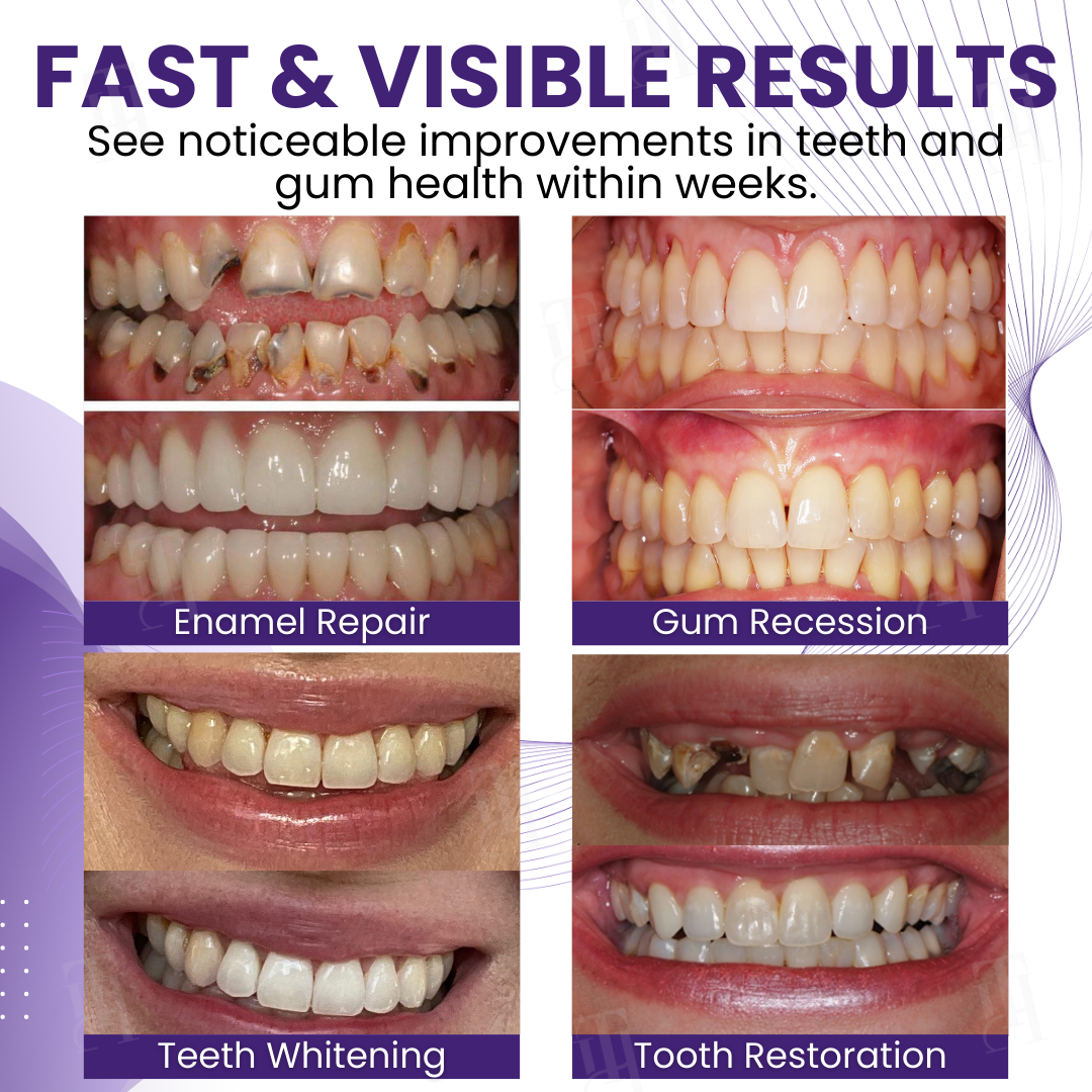 The Science of Bee Venom: Regrow Gums with AEXZR® Smileagain.