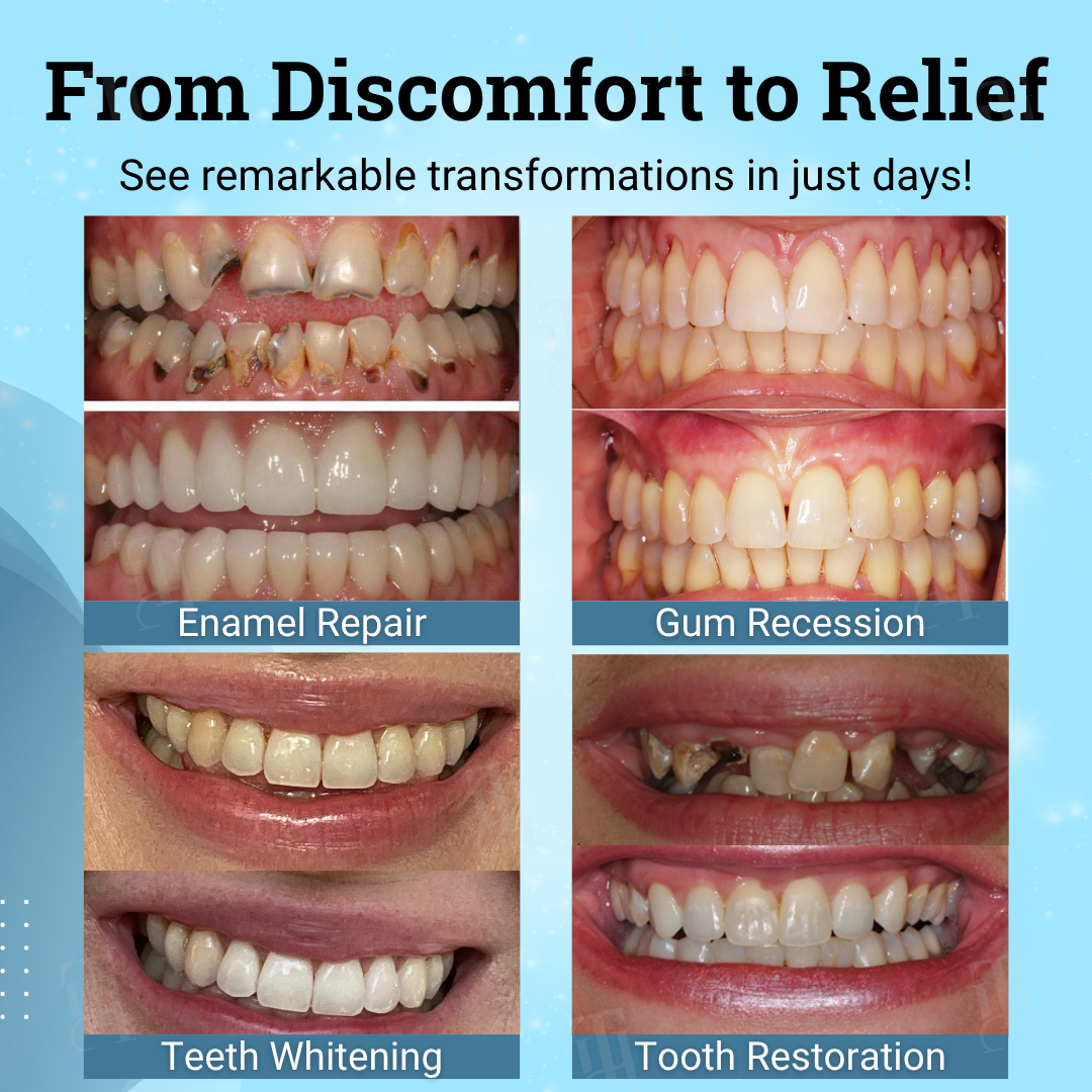 👨‍⚕️ Dentist's Choice ? AEXZR® Non-Surgical Gum "Suture" Gel